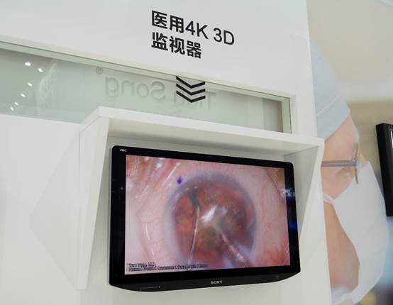 全面擁抱4K 索尼用高清影像定“醫(yī)”未來